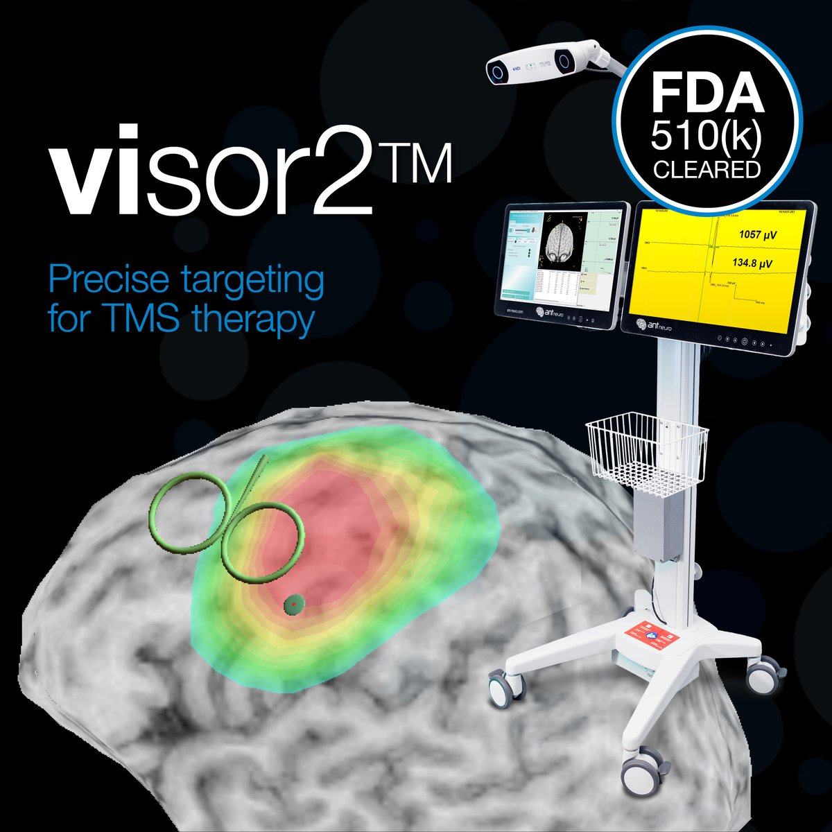 ANTNeuro's tweet photo. Our team is ready for you at the Annual meeting of the @AmEpilepsySoc tomorrow. Find us at booth 314 to learn about our high-density EEG nets for quick setup with zero compromise on signal quality. Stop by for a live demonstration!
#epilepsy #hdEEG https://t.co/uKV1bCCpNj