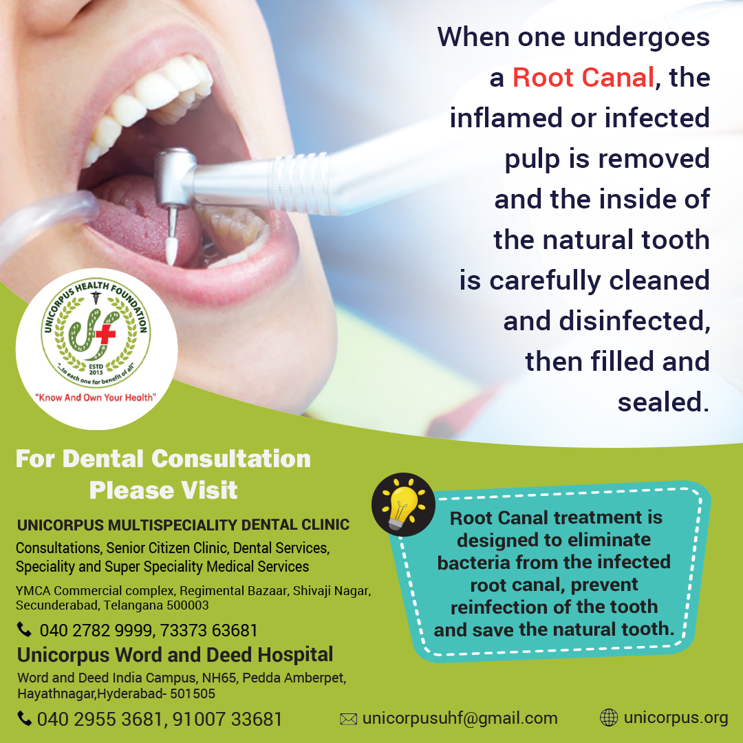 UnicorpusHealth's tweet photo. The term "root canal" comes from cleaning of the canals inside a tooth's root. 
If in severe pain or tooth sensitivity while consuming hot or cold foods and drinks.
#unicorpus #unicorpushealthfoundation #wordanddeed  #dentaltips #dental #dentalclinic #teethsenstivity #toothpain https://t.co/uom3JqOIWr
