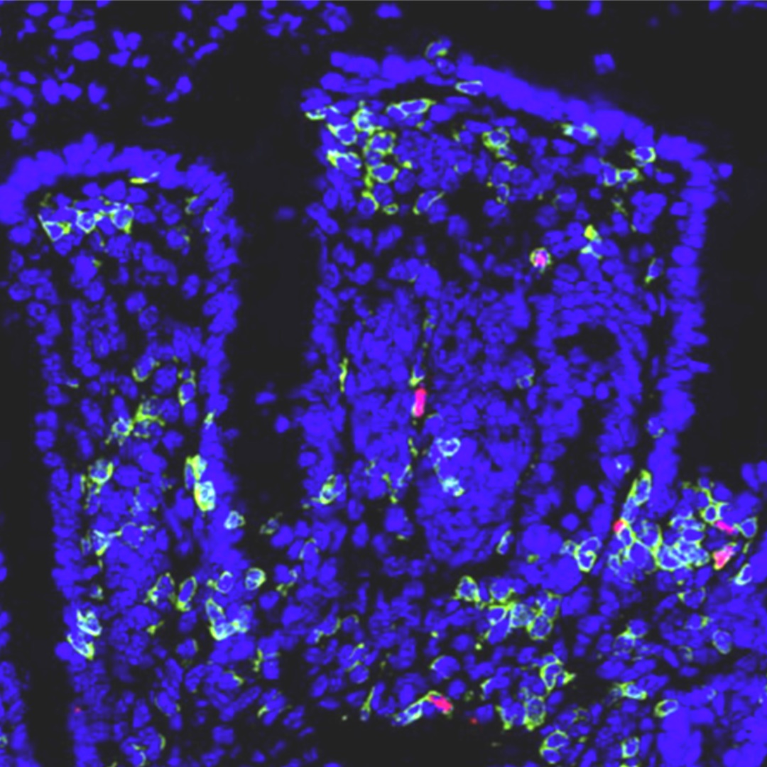 uni_mainz_eng's tweet photo. New #DFG-funded #CollaborativeResearchCenter CRC/TRR 355 under the leadership of @UnimedizinMainz to create basis for tailored #immunotherapies / Funding: about € 13 mio. https://t.co/Mk454OvCFt  #LifeSciences @LMU_Muenchen @TU_Muenchen @dfg_public @MWGRLP https://t.co/1r7rW8qNJG