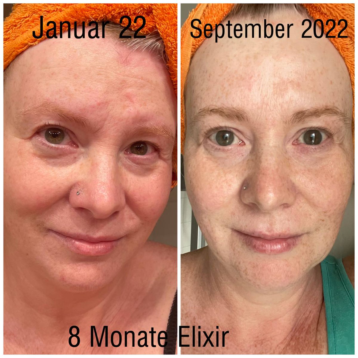 ⁣ THE ELIXIR - ein flüssiges Kollagen - hat ganz klare Vorteile zu Kollagen in Pulver- oder Tablettenform. 

Ein Produkt das jeder zuHause braucht!