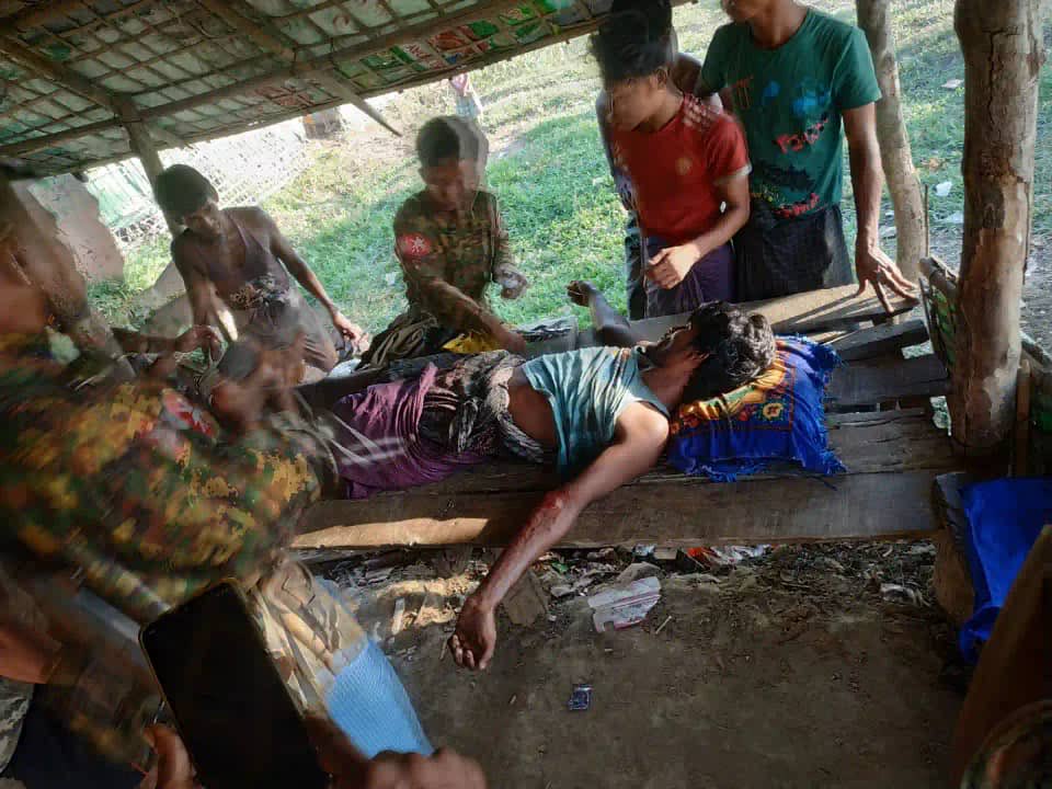 nslwin's tweet photo. A Rohingya Injured
 
A 28-year-old Rohingya, Arfan Gani, from the South hamlet of Gudar Pyin village in Rakhine State’s Buthidaung Township injured in a landmine explosion today at 2 PM. The villagers do not know which group had planted this landmine. 

#WhatsHappeningInMyanmar https://t.co/3u0NcwZ3r0