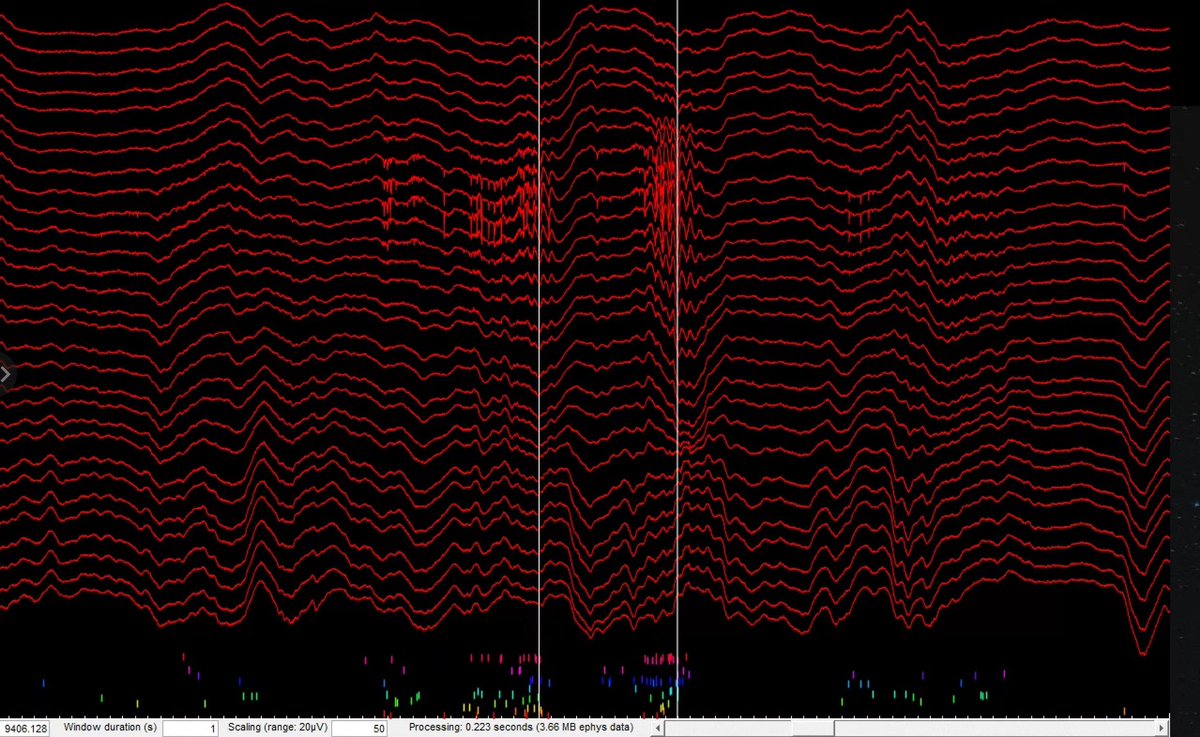 LauraBerkowitz's tweet photo. @AdrianDu_ @ElDuvelle Beautiful ripples, Adrian! @ElDuvelle here are a few ripples from my CA1 recordings. Raster below to show recruitment in ripple. The hippocampus is lovely ☺️ https://t.co/zwi3O6umZU