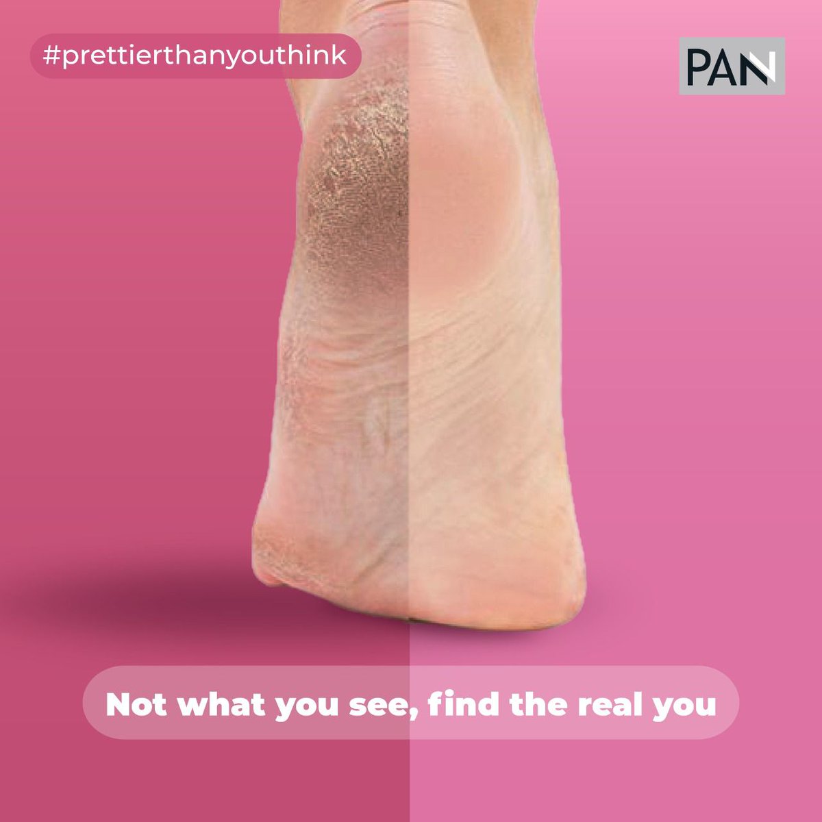 CareByPanache's tweet photo. Behind every flaw, there is a pretty you hidden in there. Let the world see your real beauty cuz you are prettier than you think.

Shop now from https://t.co/p9QZ6eAjcI
.
#prettierthanyouthink
.
#care #panache #carebypanache #threading #eye #beautyproducts #body #bodycare https://t.co/vPaNZbXh0d