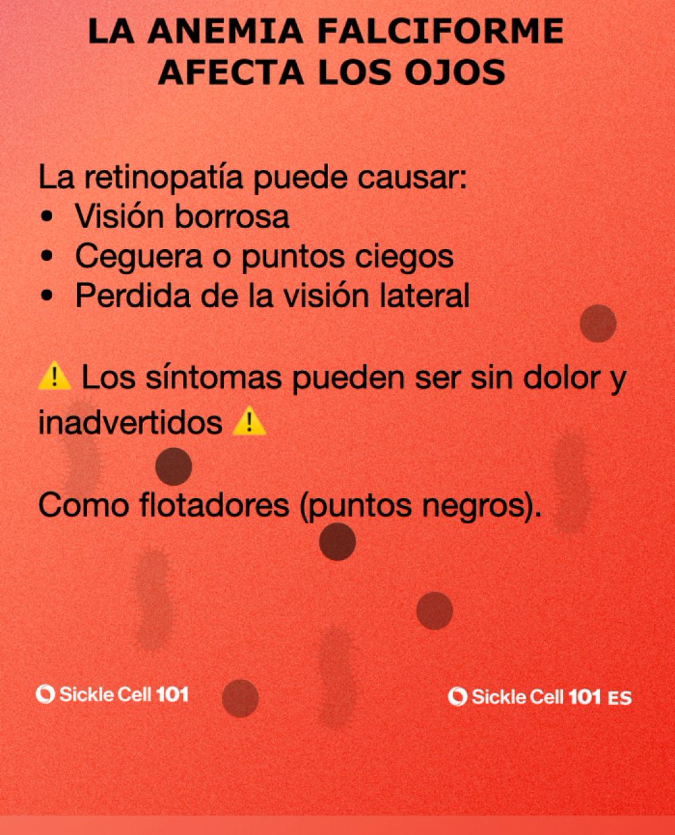 SickleCell101ES's tweet photo. La retinopatía (desprendimiento de la retina): los pequeños vasos sanguíneos alrededor del ojo se debilitan y se rompen debido al bloqueo que se forma por la oclusión de los vasos.

Comience a ver a un oftalmólogo anualmente a partir de los 10 años.

#sicklecell #sicklecell101 https://t.co/Yk9oWWx8M2
