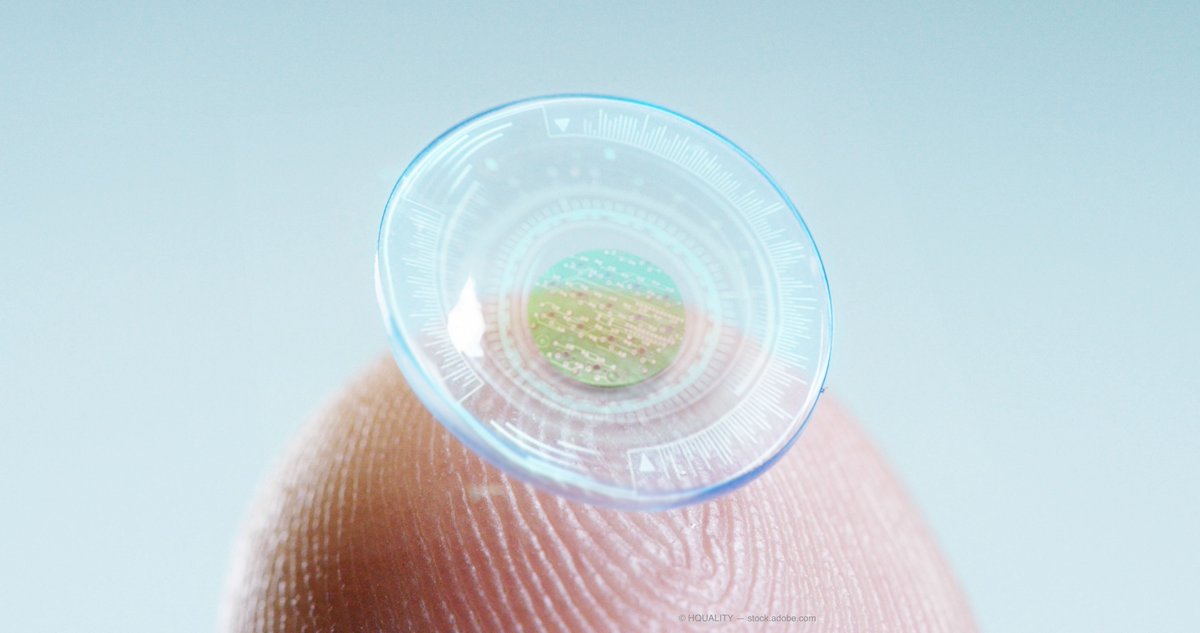 OptometryTimes's tweet photo. Researchers test 3D-printed, self-moisturizing contact lens
More: https://t.co/KvYYAQSzYa
#Optometry #LensTech #Technology #ContactLens https://t.co/C7TezDT6jh