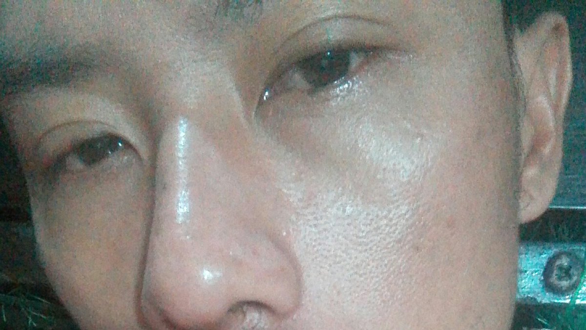 KyawKyiLin1's tweet photo. တစ္ခါတစ္ယံဆိုအလိုလိုေနရင္းဝမ္းနည္းလာတယ္ဘာဝမ္းနညး္စရာအေျကာင္းမွမရိွပဲျဖစ္လာတာရင္ထဲဘယ္လ��ုျကီးျဖစ္မွန္းလည္းမသိဘူးဆို့ဆို့ျကီးနဲ့ခဏတမ္းျဖစ္တက္တာအဲ့ဒါဘာေျကာင့္လဲသိရင္ေျပာျပျကပါလား https://t.co/J2fr8r3Xj0