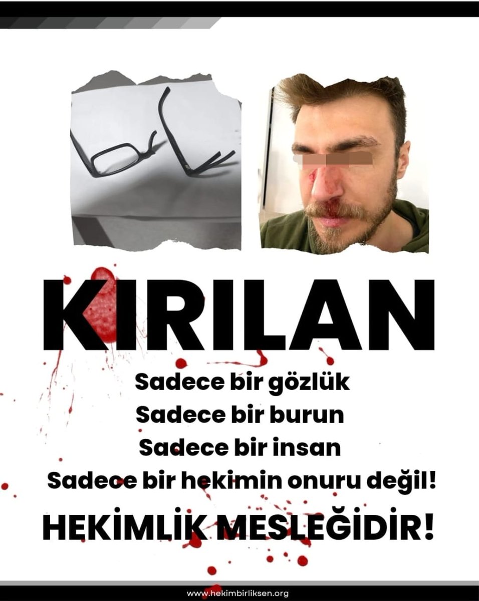 Son günlerde artan hekime şiddet terörü sebebiyle büyük bir üzüntü ve öfke içerisindeyiz.
Muayene süreleri yetersizliği yanında ek randevuların yarattığı kaotik ortamla şiddet tetiklenmektedir.
<a href="/tepecikeahast/">SBÜ Tepecik Eğitim ve Araştırma Hastanesi</a> de terörü kınamak için 01.12.2022 tarihli iş bırakma kararı alınmıştır.