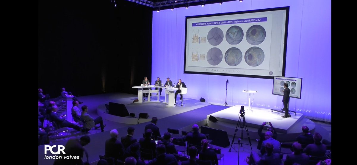 #pcrlv <a href="/DrArifK/">Arif Khokhar</a> speaking about Coronary access after TAVI in TAVI with ACURATE neo2

<a href="/CurioJonathan/">Jonathan Curio</a>
<a href="/ABeneduceMD/">Alessandro Beneduce</a>
<a href="/fra_giannini1/">Francesco Giannini</a>
<a href="/PKardiolog/">Profesor Dariusz Dudek - kardiolog</a>
<a href="/dmylotte/">Darren Mylotte</a>
<a href="/MarcFeeley/">Marc Feeley</a>
<a href="/J_Sathananthan/">Janar Sathananthan</a>
<a href="/MarkGrygier/">mark grygier</a>
#borofellow
