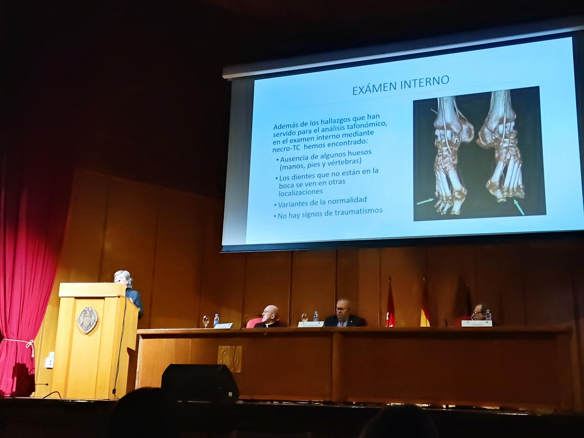 LAOF_EML's tweet photo. Muchas felicidades a nuestras compañeras María Benito, Patricia Moya, Mónica Rascón e Isabel Angulo por su excelente investigación y presentación de los resultados del estudio antropológico forense de San Isidro Labrador 💀🦴🦷 #AntropologiaForense #OdontologiaForense #UCM #LAOF https://t.co/uSgmhdOb5B