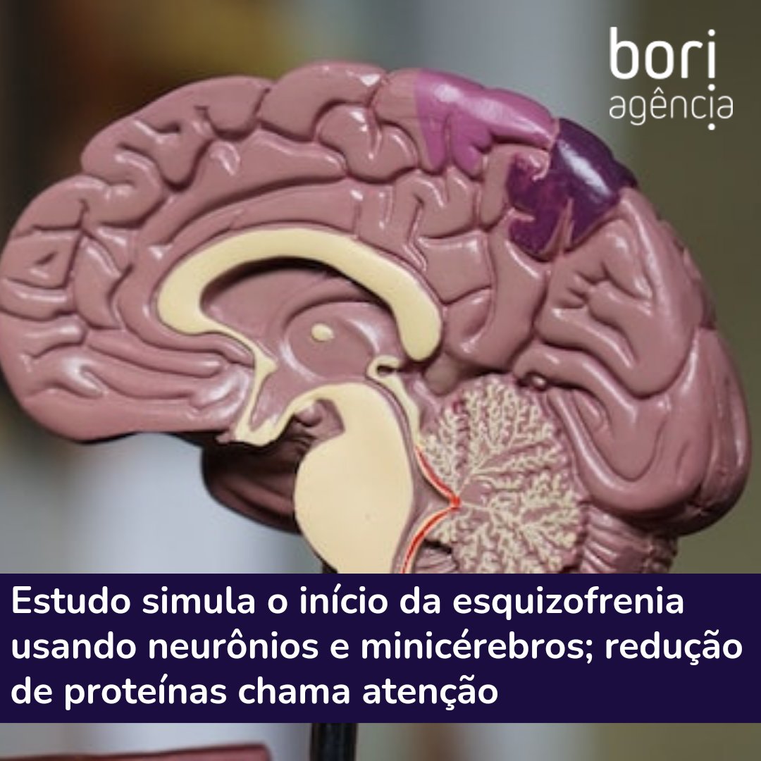 Novo estudo de pesquisadores da <a href="/neuroproteomics/">Lab of Neuroproteomics</a> da <a href="/unicampoficial/">unicampoficial</a> identificou padrões que indicam o início da esquizofrenia em organismos através do mapeamento da composição proteica de três modelos in vitro de neurônios e minicerebros.