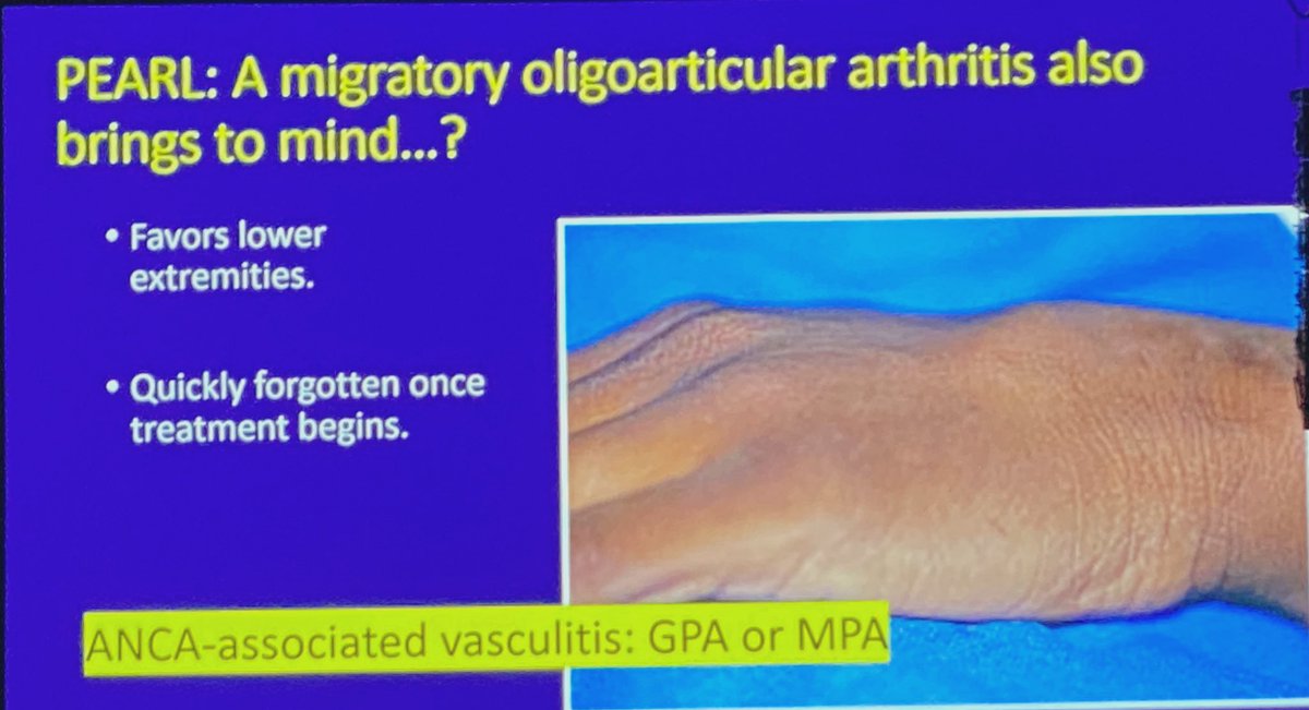 Migratory oligoarthritis can be an early sign of #ANCA vasculitis
#GPA #MPA #ACR22 #ClinicalPearl