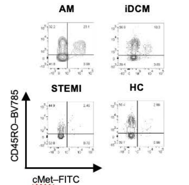#OriginalResearch Memory T-lymphocytes (cMET+) offer a novel mechanism to diagnose and monitor cardiac inflammatory conditions <a href="/mohiddinsam/">Sam Mohiddin</a> <a href="/ProtonotariosA/">Alex Protonotarios</a> <a href="/KSavvatis/">Konstantinos Savvatis</a> @eSOLITOLab #AHAJournals ahajrnls.org/3VnCPQP