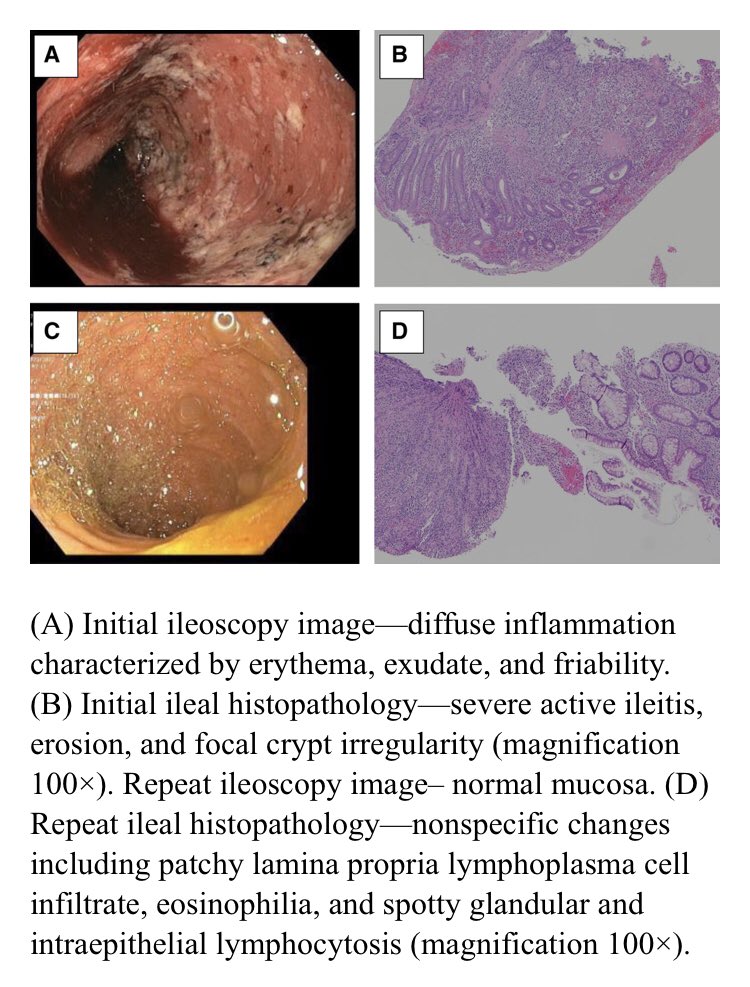 JPGN Reports tweet media