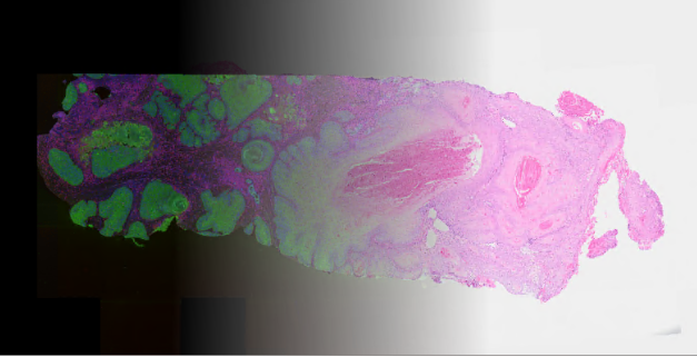 <a href="/miCHRIScopy/">Christoph Spahn</a> That's super-funky! Not the most clear, but regardless very cool!