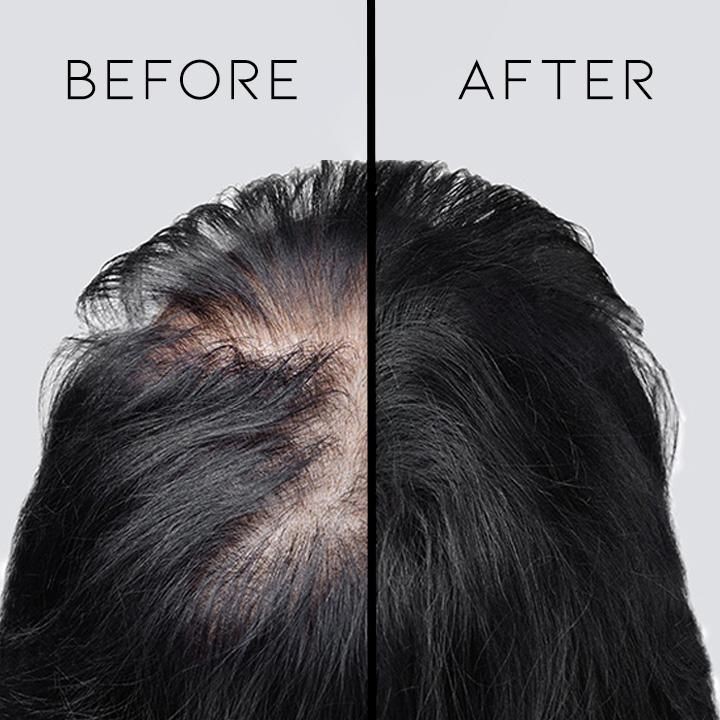 coekisss's tweet photo. Best Treatment rambut rontok &amp; ketombe !!

-A Thread- https://t.co/oB48YNVQdy