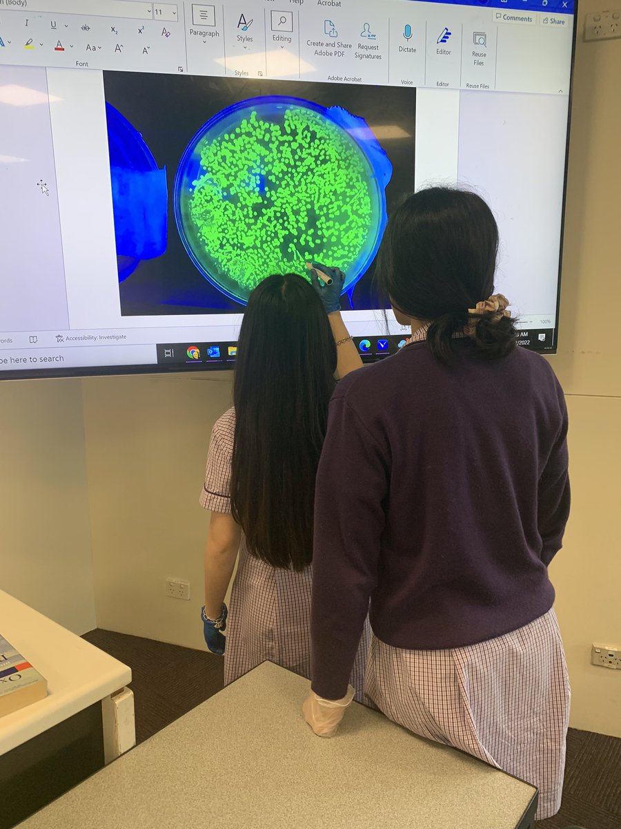 BeckRSaunders's tweet photo. #IB #Biology #Topic3 #BacterialTransformation …. Counting colonies @BioRadEducation @BioRad https://t.co/6Gjo8uU6y7