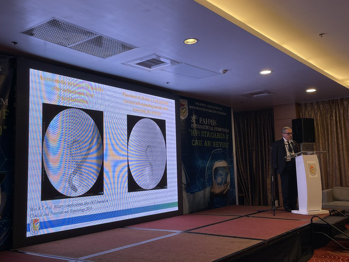 PAHPBS1's tweet photo. ATM at the 3rd PAHPBS International Symposium, “Biliary Complications after Biliary Transplant” by Prof Gazi Zibari @ZibariGazi 

#pahpbs #hpbsurgery #qualitysurgery #livertransplantsurgery #3rdinternationalsmposium #continuingsurgicaleducation https://t.co/YQNval7rXE