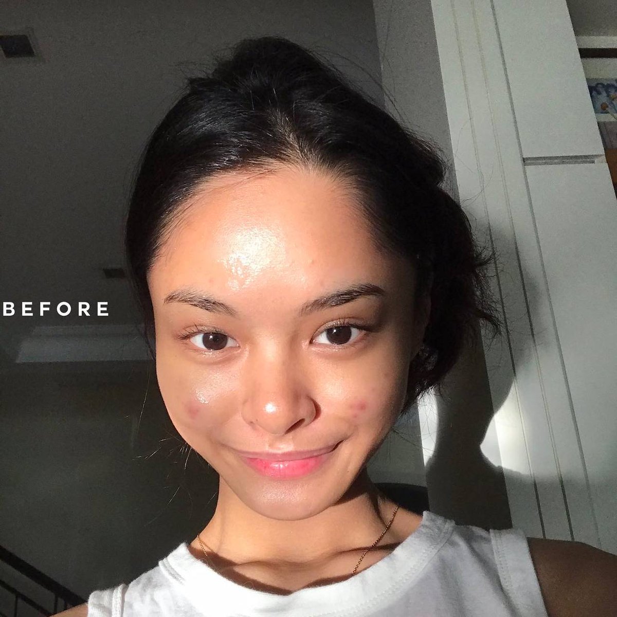 HaengbogSkin's tweet photo. Gorgeous gorgeous girl, what makes your redness gone &amp; your skin glow? ✨

Before :                                  After : https://t.co/A5hE0r0o9k