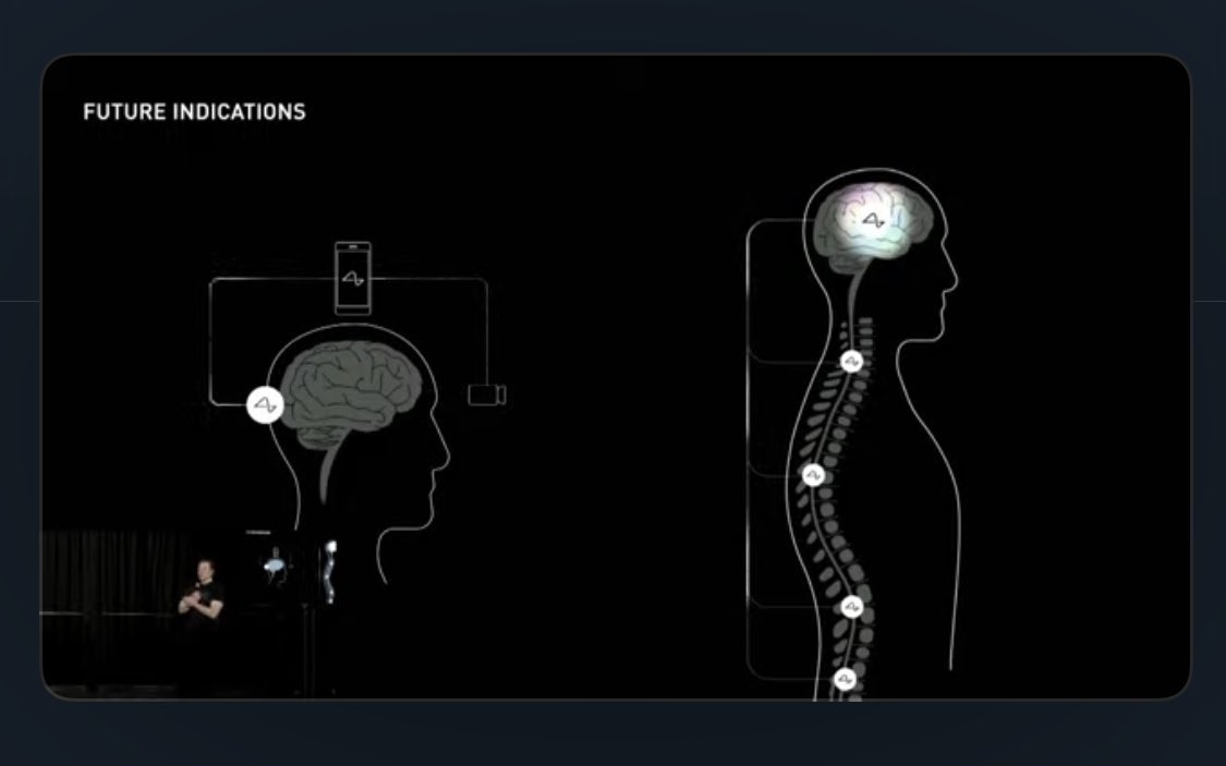 TylerDurden's tweet photo. Neuralink can restore full body functionality, it’s going to begin with restoring vision and then move on to body paralysis.

How fn incredible. https://t.co/eSrbFezxOc