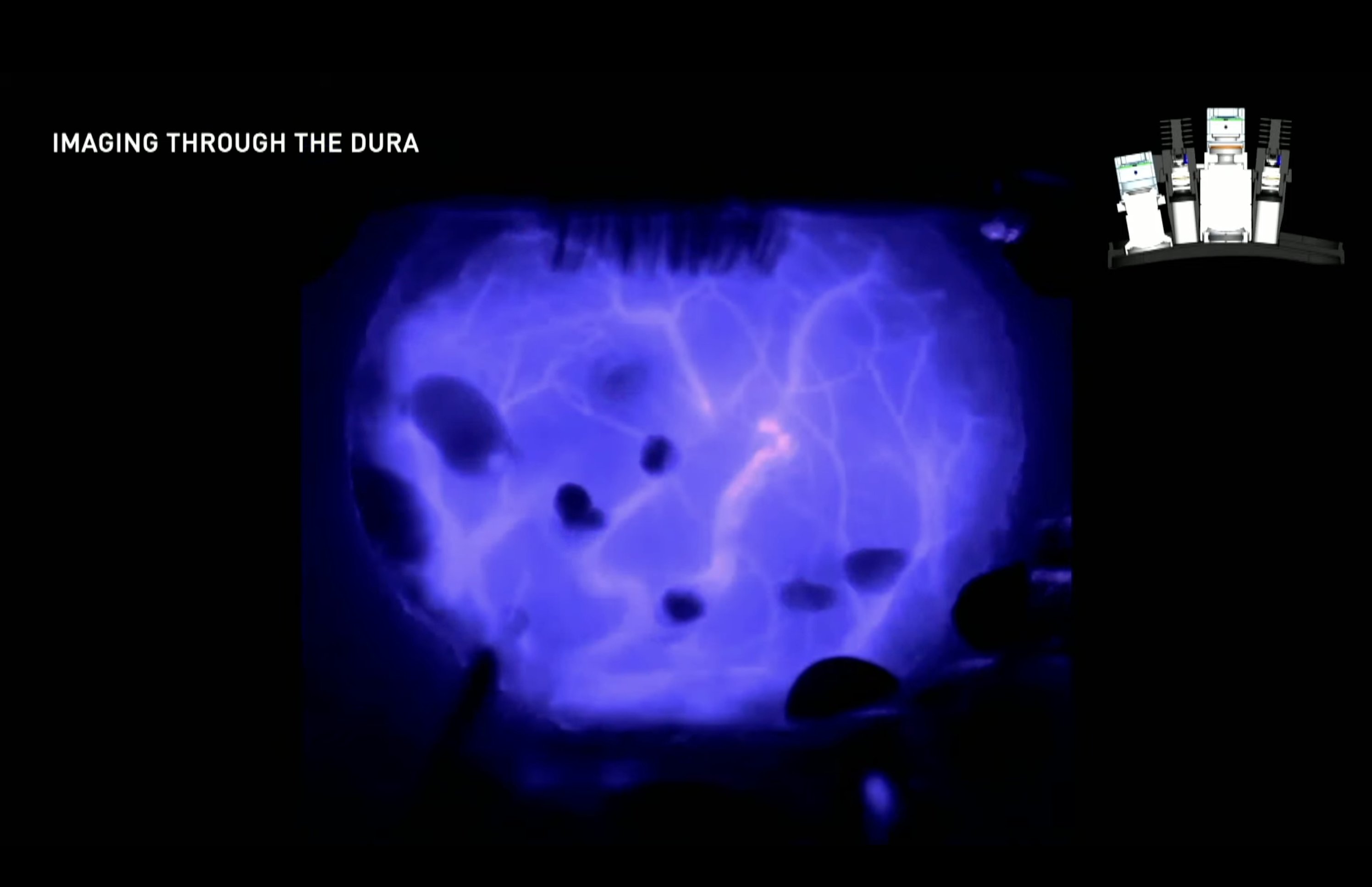 Stephen Shankland on Twitter: "Here's Neuralink working on technology