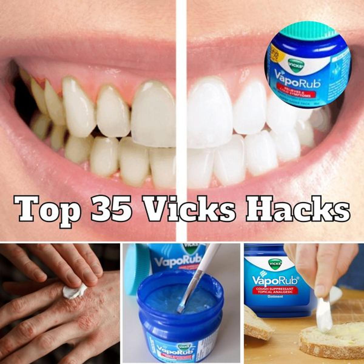 HistoryA2Z on Twitter "Rub Vicks VapoRub On Your Feet At Night, Here's