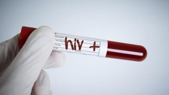 Advancells's tweet photo. A patient with leukemia in the United States has become the first woman and the third person to date to be cured of #HIV after receiving a #stemcell transplant, #researchers say.
https://t.co/s2z2sF1Es9

#hivpositive #hivawareness #WorldAIDSDay #HIVprevention https://t.co/xN8vUTtwaF