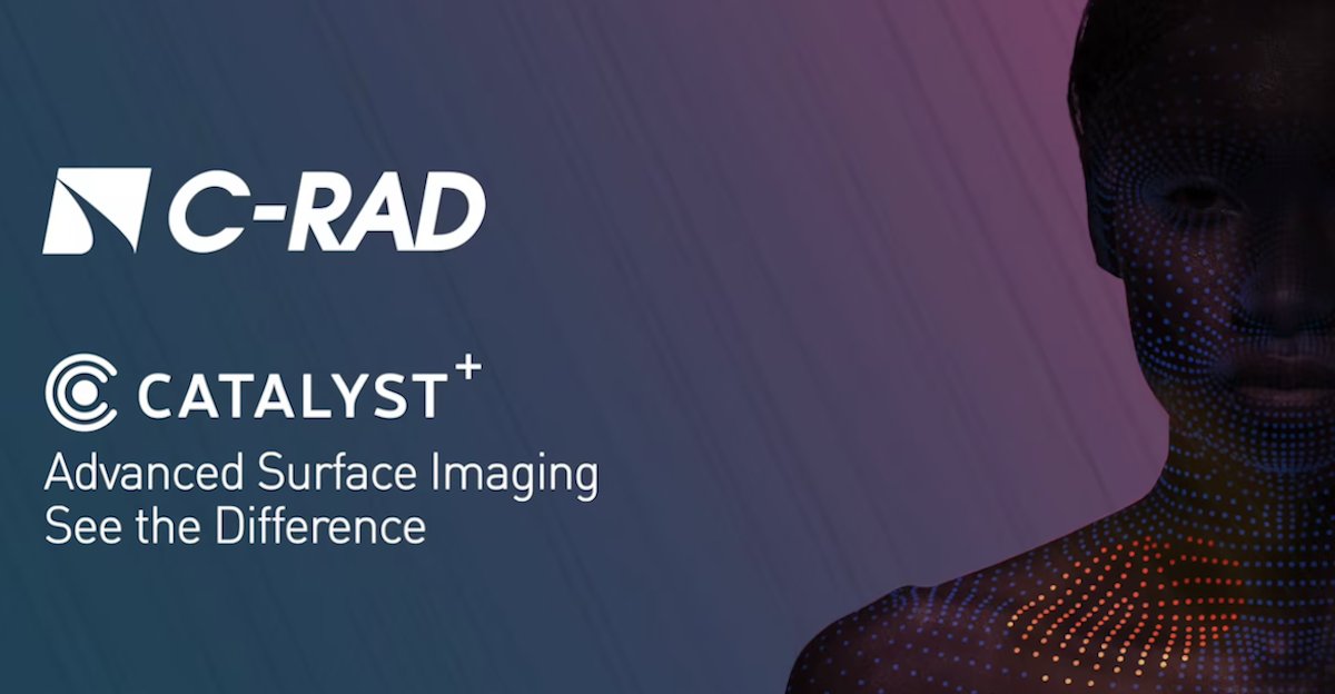 CPositioning's tweet photo. See how C-RAD can help make radiation treatments safer and more precise. Watch our short DIBH demo video, featuring comments from C-RAD users: https://t.co/xATFXob29L
#medphys #radonc #RTT #patientpositioning #surfacetracking #radiotherapy #cancertreatment #sgrt #sigrt #cradab https://t.co/QUPGTrszNC