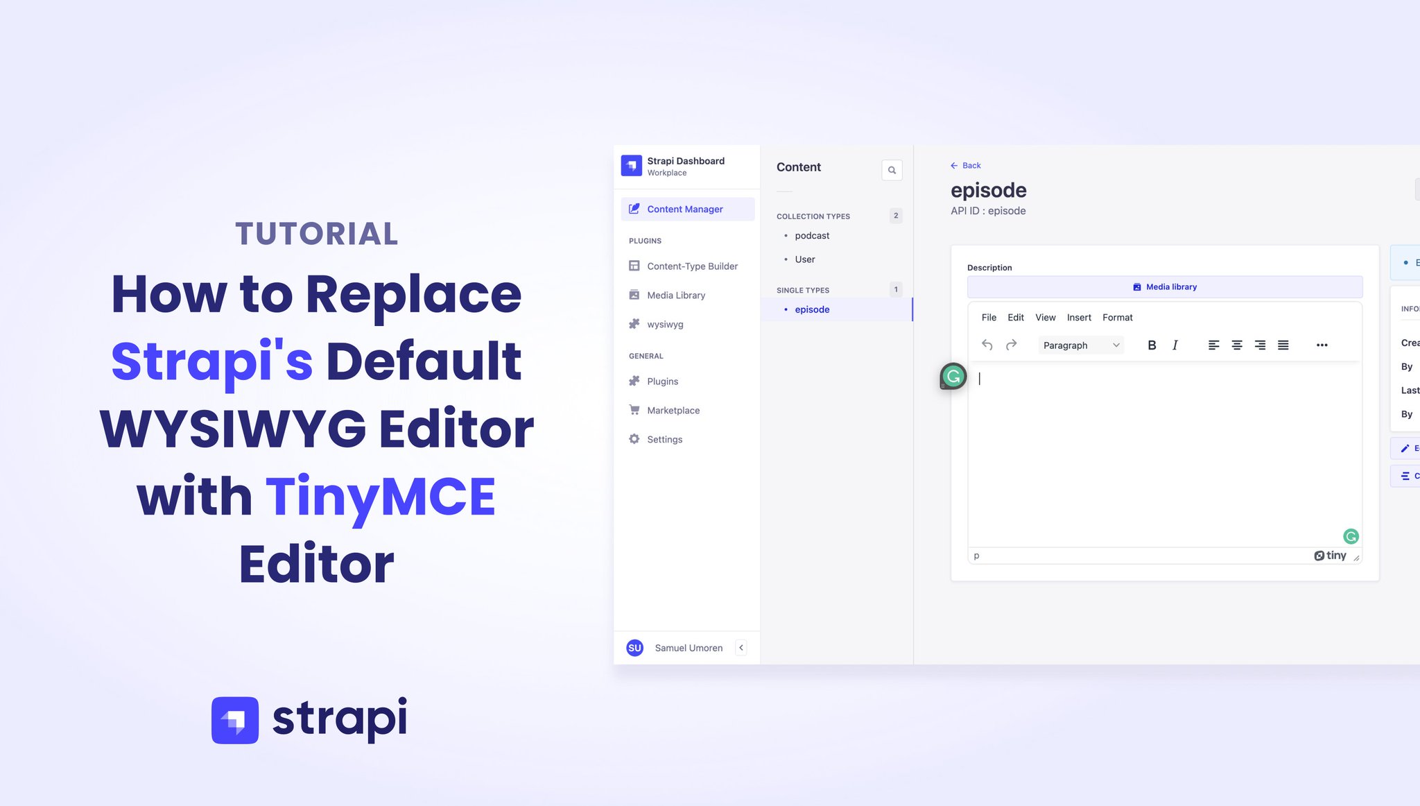 Strapi on X: "Learn how to replace the default WYSIWYG editor (Draftjs) in # Strapi with the #TinyMCE editor ✍️: Samuel Umoren https://t.co/5ZoHt3WyIa https://t.co/klBkJPsKu4" / X Strapi on X: "Learn how to replace the default WYSIWYG editor (Draftjs) in # Strapi with the #TinyMCE editor ✍️: Samuel Umoren https://t.co/5ZoHt3WyIa https://t.co/klBkJPsKu4" / X