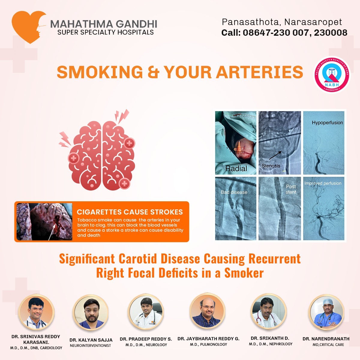 Significant carotid disease causing recurrent right focal deficits in a smoker. 

#Pulmonology #Pulmonologydoctors #lungs #lungscare #healthylungs #quitsmoking #smoking #healthyhabits #life #healthylife #hospitals #PulmonologyHospitals #narasaraopeta #narasaraopet #palnadu