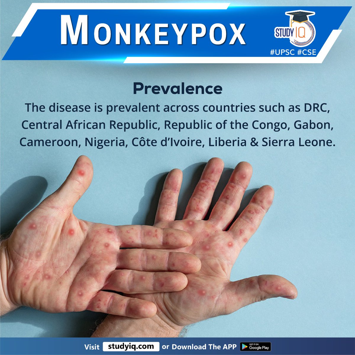 upsciq's tweet photo. #Monkeypox
#WHO #mpox #orthopoxvirus #whyinnews #variolavirus #drc #centralafricanrepublic #congo #gabon #cameroon #nigeria #liberia #sierraleone #domocraticrepublicofcongo #humantransmission #bodilyfluids #skinlesions #fever #lymphnodes #sysmptoms #muscleaches #headache https://t.co/rXLtstn8FG