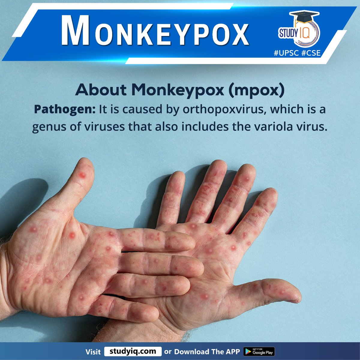 upsciq's tweet photo. #Monkeypox
#WHO #mpox #orthopoxvirus #whyinnews #variolavirus #drc #centralafricanrepublic #congo #gabon #cameroon #nigeria #liberia #sierraleone #domocraticrepublicofcongo #humantransmission #bodilyfluids #skinlesions #fever #lymphnodes #sysmptoms #muscleaches #headache https://t.co/rXLtstn8FG