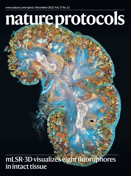 Dream3D Lab (@dream3dlab) on Twitter photo Really proud to see our data and eight color 3D microscopy technique featured on this month’s cover of <a href="/NatureProtocols/">Nature Protocols</a>! Really proud to see our data and eight color 3D microscopy technique featured on this month’s cover of <a href="/NatureProtocols/">Nature Protocols</a>!