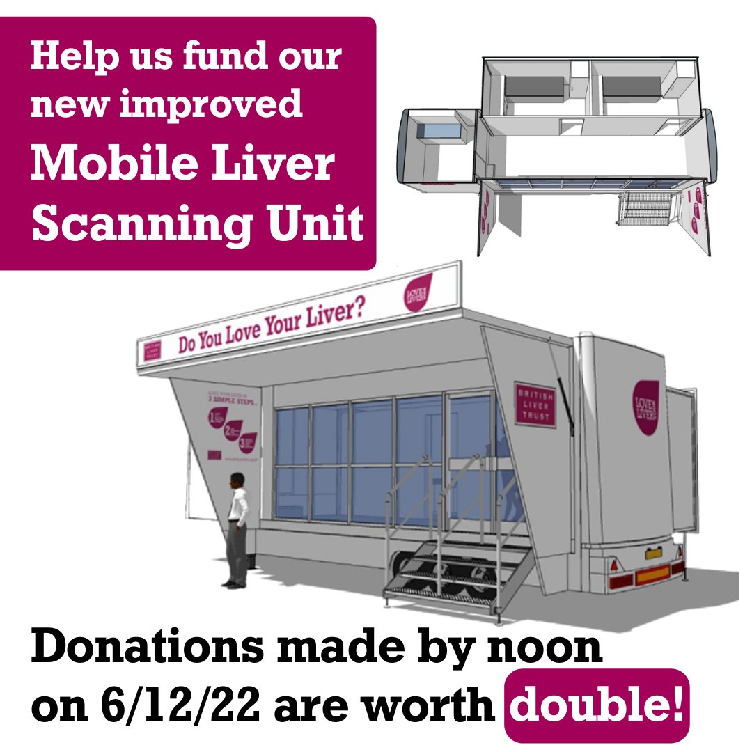 British Liver Trust (@livertrust) on Twitter photo Early diagnosis saves lives. We're raising funds to replace our mobile scanning unit, which allows us to help identify people at risk of liver disease.
This week donations made through our #BigGive page are ๐ฐ๐จ๐ซ๐ญ๐ก ๐๐จ๐ฎ๐๐ฅ๐. Please help if you can: britishlivertrust.org.uk/biggive22 Early diagnosis saves lives. We're raising funds to replace our mobile scanning unit, which allows us to help identify people at risk of liver disease.
This week donations made through our #BigGive page are ๐ฐ๐จ๐ซ๐ญ๐ก ๐๐จ๐ฎ๐๐ฅ๐. Please help if you can: britishlivertrust.org.uk/biggive22