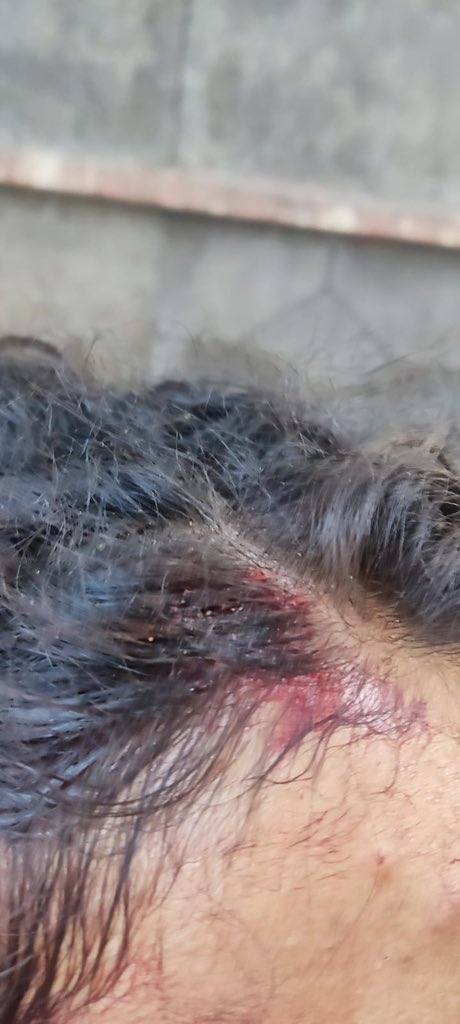 SafooraZargar's tweet photo. CASR activists beaten up brutally by ABVP goons in Delhi university while campaigning for their program on 5th dec at HKS Surjeet Bhawan to demand release of GN Saibaba. While innocent student activists rot in jail, the criminal activities of ABVP are given a free pass. + https://t.co/Yb5KVf5tOv