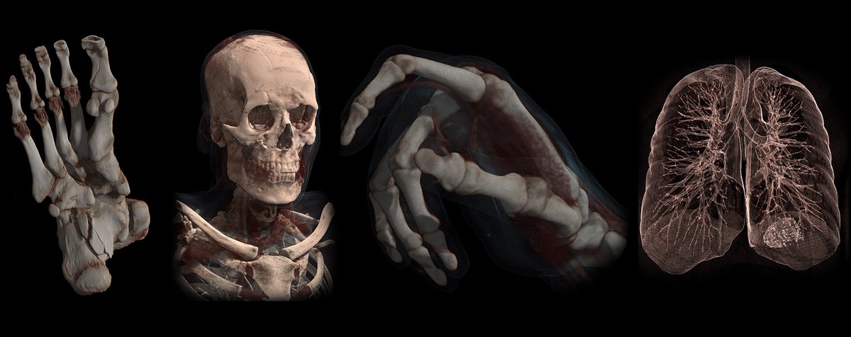 Horos Mobile™ tweet media