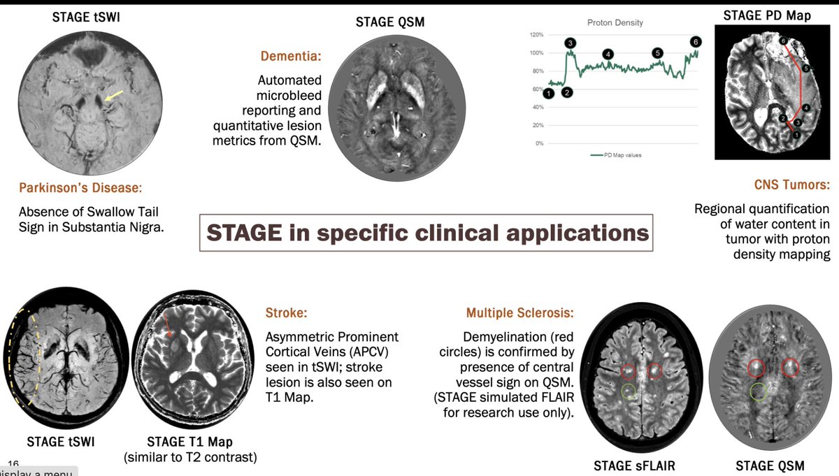 Mariam Aboian tweet media