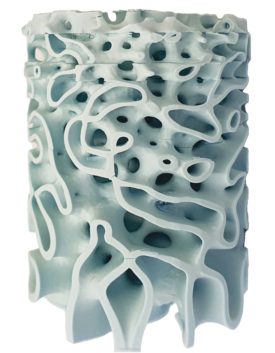 3DPrintingJrnl's tweet photo. #OpenAccess: #3Dimensional Printed Hydroxyapatite Bone Substitutes Designed by a Novel Periodic Minimal Surface Algorithm Are Highly Osteoconductive published recently in @3DPrintingJrnl 
https://t.co/4S53tZxvsw https://t.co/9gMxdOTltZ