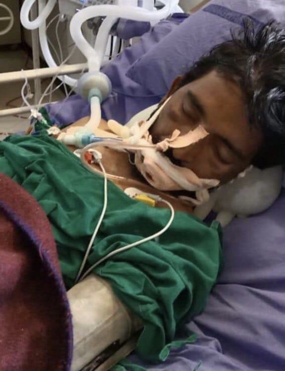 सिरोही पुलिस ने अभी तक पता नही किया कार्तिक भील के हाथ पैर तोड़ दिए आज मारपीट भारी हुई जिससे उनकी मौत हो गई फिर भी प्रसाशन चुप है मृत परिवार को आर्थिक पैकेज के साथ न्याय दिलाने भीलप्रदेश द्वारा बड़ा आंदोलन किया जाएगा 🏹🙏