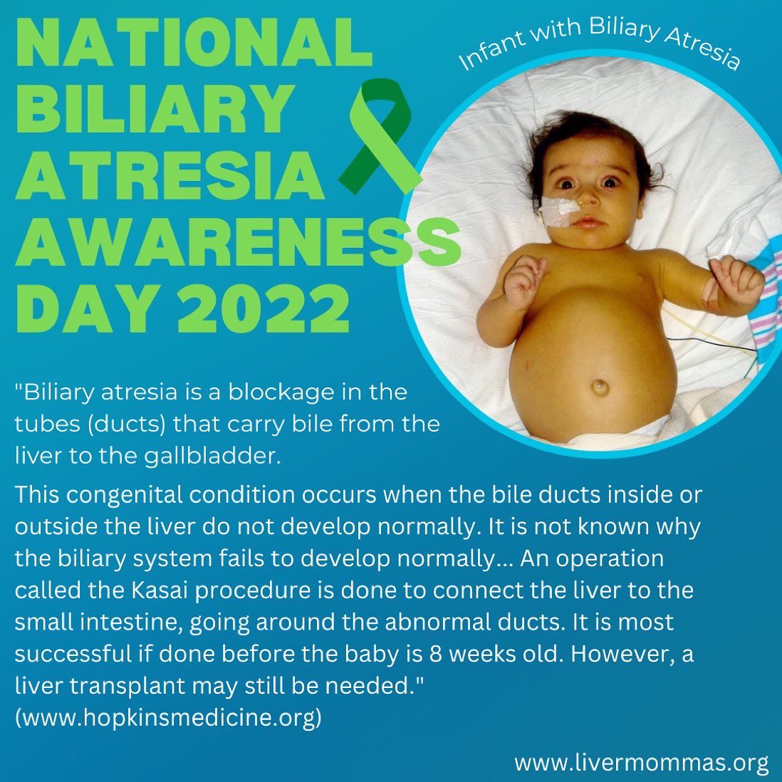 December 1st is  National Biliary Atresia Awareness Day 💚

Today we honor all the Biliary Atresia warriors in our community and their families! We also hold a special place in our hearts for those who were taken too soon because of this disease 💔
#biliaryatresiaawarenessday