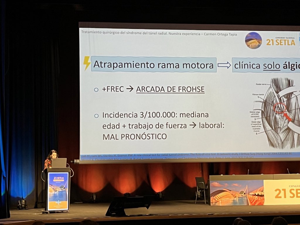 Dra. Carmen Ortega se <a href="/Asepeyo/">Asepeyo</a> Tratamiento quirúrgico del síndrome del túnel radial en congreso <a href="/SETLA11/">SETLA</a>