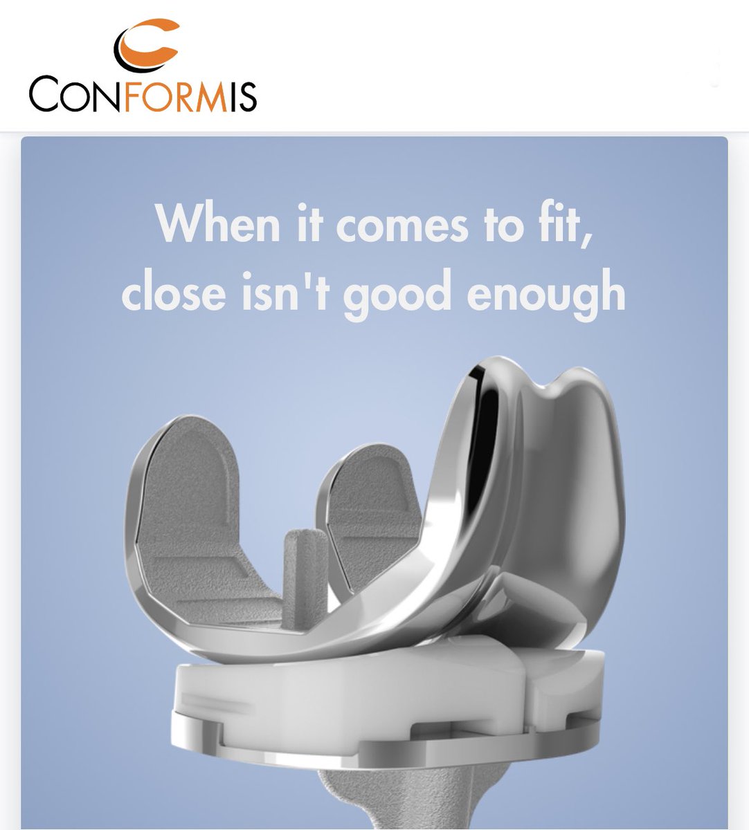 Peter Kempshall (@kempshallpeter) on Twitter photo The fully customised Conformis itotal knee replacement is manufactured and shaped to the fit your knee. It differs from conventional knee replacements as each half of the joint is treated separately with the aim of giving you a more normal feeling knee. <a href="/ConformisUk/">Conformis UK</a> The fully customised Conformis itotal knee replacement is manufactured and shaped to the fit your knee. It differs from conventional knee replacements as each half of the joint is treated separately with the aim of giving you a more normal feeling knee. <a href="/ConformisUk/">Conformis UK</a>