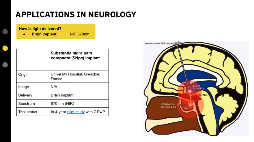 parkython's tweet photo. 12/ Finally, we saw a brain implant study for PD out of University Hospital, Grenoble. Near-infrared waves are emitted directly into the substantia nigra pars compacta (SNpc) to assess the effect of light therapy on motor and non-motor function.  https://t.co/CQDCSro90G https://t.co/bNGZCGDBLn