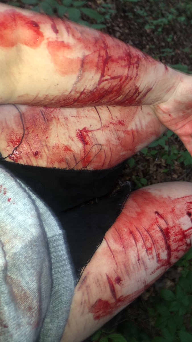 Namseldon12's tweet photo. 5htwt goretwt bloodtwt redinktwt redink 988twt sfx fake https://t.co/hzpXzyqFNS