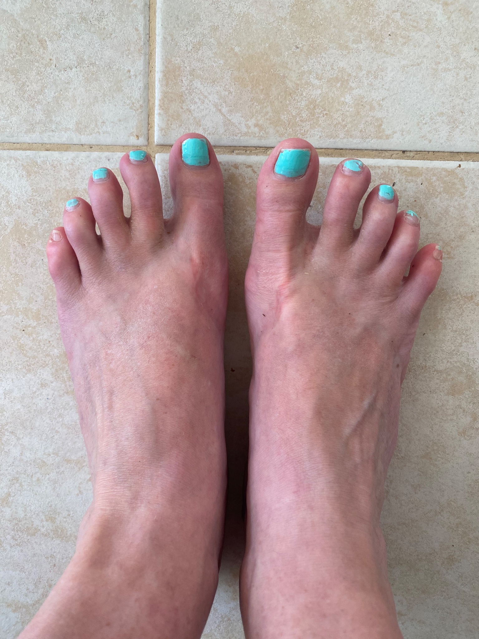 Pop Star Joins Onlyfans For Feet Photos - g5kt7ps