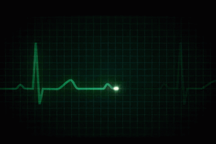 NishantS101's tweet photo. 1/17
My first #tweetorial with @MedicsAcademy

Making sense of lines – An intro to ECG interpretation

ECGs can be a pain to interpret, so why not get a head start in preparing for your exams and clinical years?

Hope you remember your anatomy!
#medtwitter #medicalstudent https://t.co/FSUutrUafD