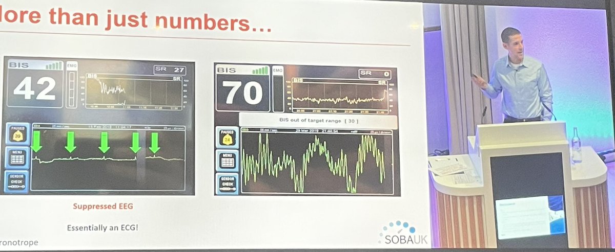 Lesson 1 from @Chronotrope It’s not just numbers! (But you can’t write 70 on the chart!) #SOBAUK2022 @SOBAuk