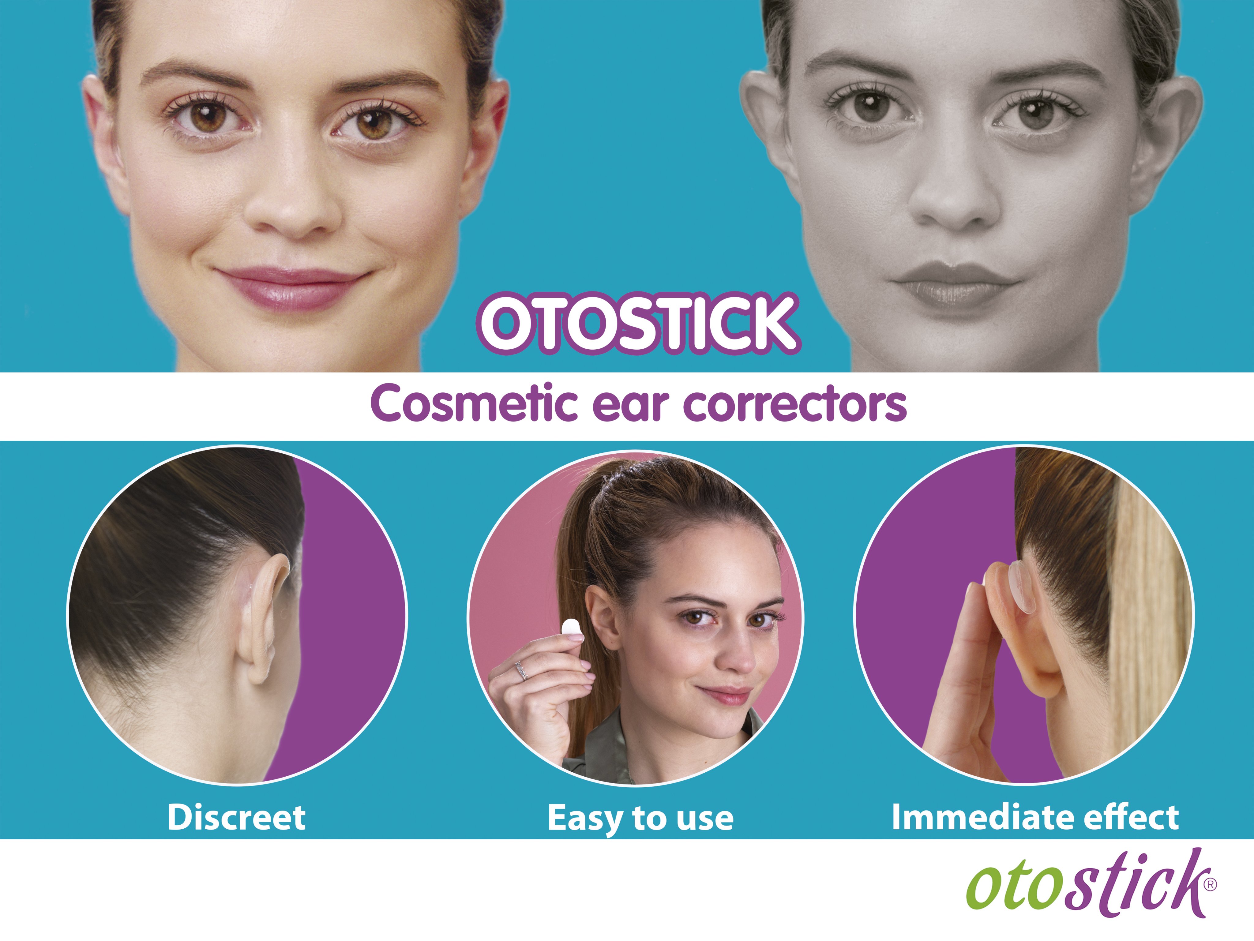 Otostick UK on X: Otostick ear correctors are easy to use and very  discreet. Buy now at   / X