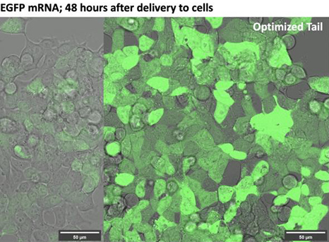 Modified mRNA Demonstrates 10-Fold Protein Production

Scientists at Hong Kong University of Science and Technology came up with a technique to increase the efficiency and potentially the efficacy of mRNA therapeutics. mRNA molecules have what is ca…
medgadget.com/?p=1542445&utm…