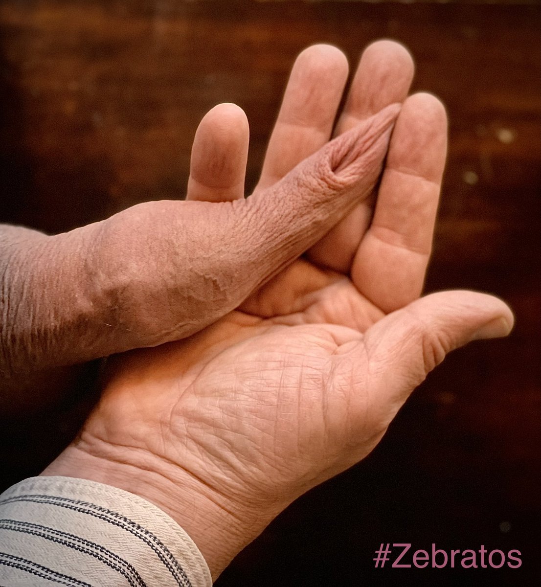 zebratoskin's tweet photo. We know what kind of Friday it is, right? #ForeskinFriday #foreskin #TeamUncut #intactpenis #naturalcock #overhang #softcock #pleasant #pull #gay #zebratos https://t.co/2tgH9sH2li