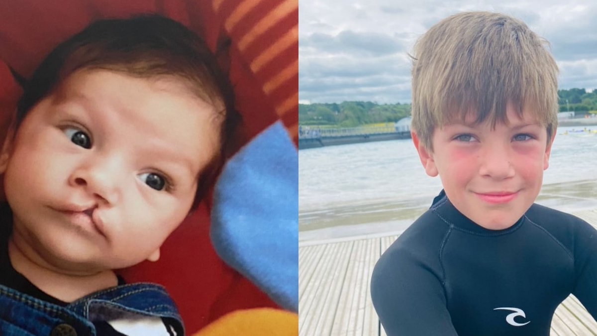 OpSmileUK's tweet photo. Barnaby &amp; his friends from @ThurlbearSchool are true #SmileHeroes! They've raised more than £3,000 for #OperationSmile after hiking for 10 miles in wind &amp; rain! Barnaby was born with a #cleft lip &amp; palate which made him want to help other children with #cleftconditions.  ❤️💪 🦸‍♂️ https://t.co/L9Ib34Cf1k